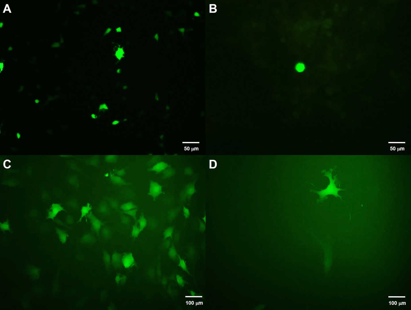 The effect of different virus concentration methods on transfection efficiency was tested, and the expression of GFP protein was observed under a fluorescence microscope after 48 hours. (OA Literature)