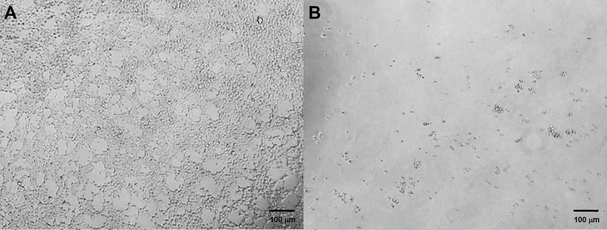 Tumor cells infected with lentivirus were screened using different concentrations of puromycin. (OA Literature)
