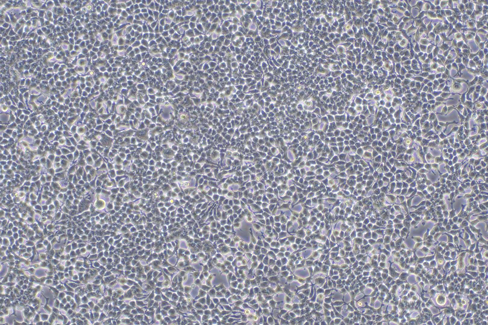 Observe the HEK 293 cells infected with LV-GFP under a bright field using a microscope. (Creative Biolabs Original)