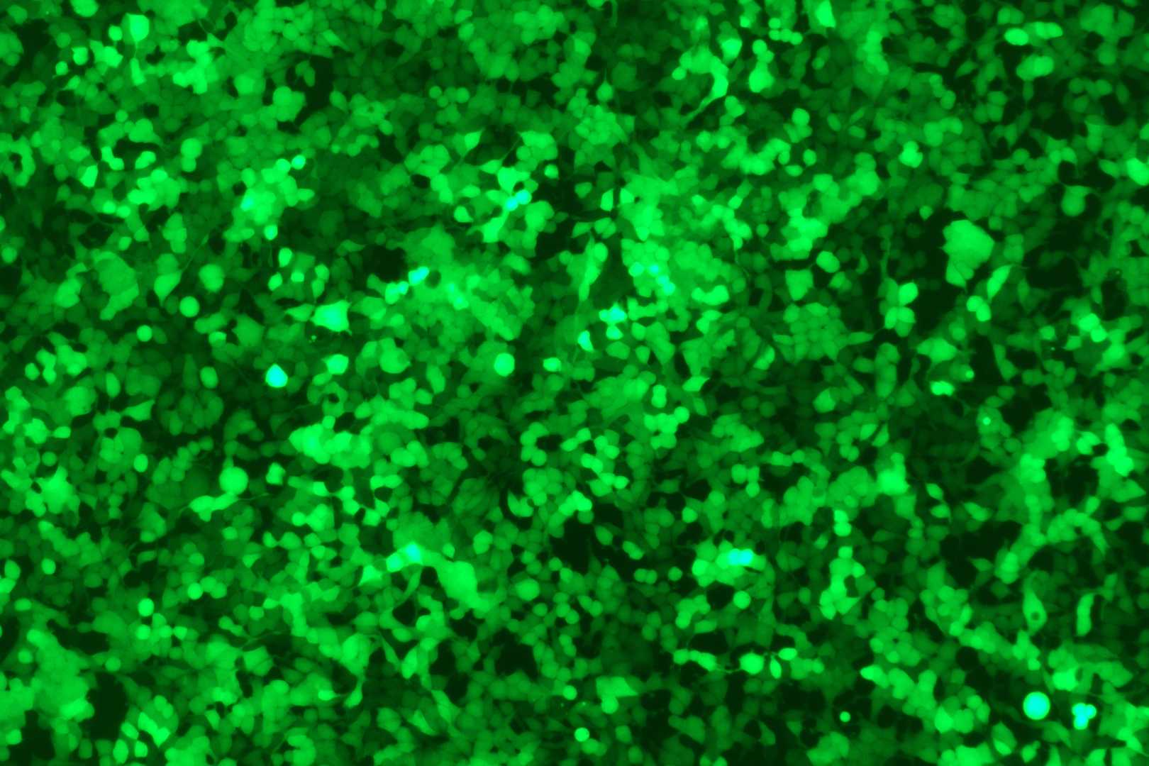 The expression of GFP in HEK-293 cells infected with LV-GFP was observed under fluorescence using a microscope. (Creative Biolabs Original)