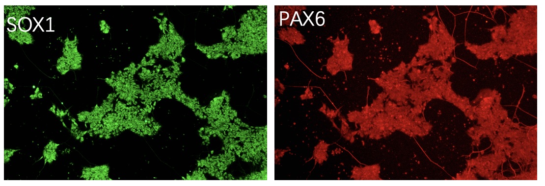 QC of GABA Precursor cells. (Creative Biolabs Original)