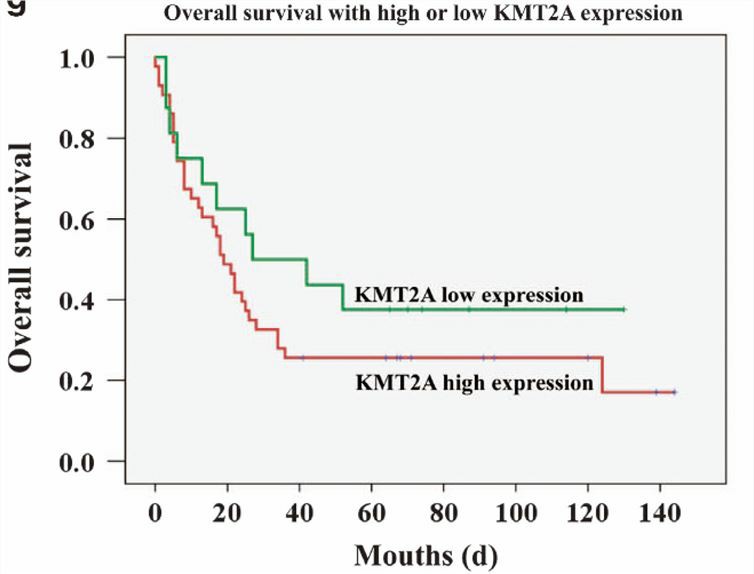 Patients with high expression of KMT2A have poor overall survival