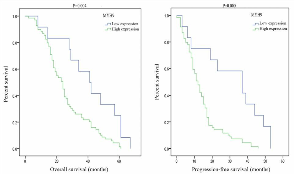 MYH9 overexpression is associated with poor survival rates in EOC patients