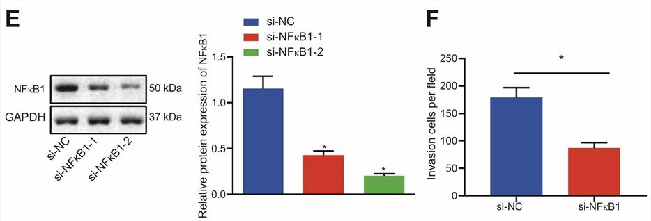 Knockdown of NFKB1 can decrease the invasion ability in the OC cell line