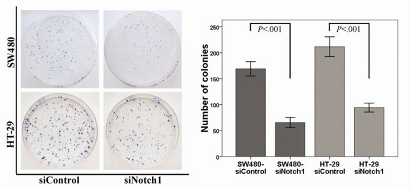 Knockdown of NOTCH1 inhibits the colony formation of CC cell lines