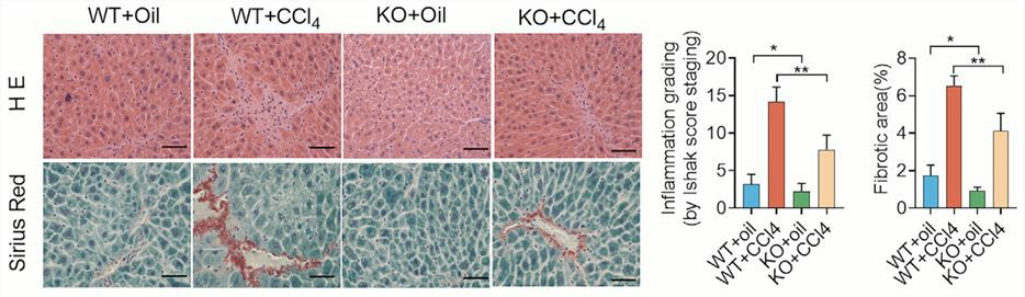 NPAS2-knockout mice are protected against CCL4-induced LF
