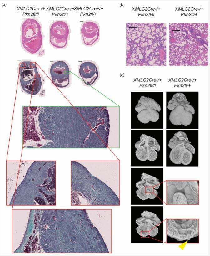 PKN2 knockout in cardiomyocytes causes defective embryonic heart development leading to failure prior to adulthood.