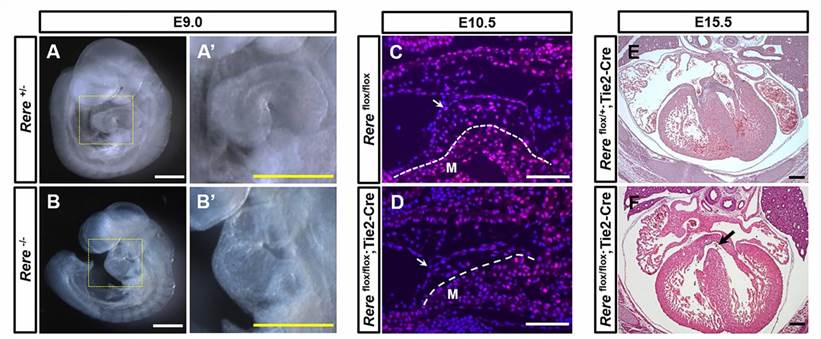 Ablation of RERE in the endocardium leads to the development of ventricular septal defects.
