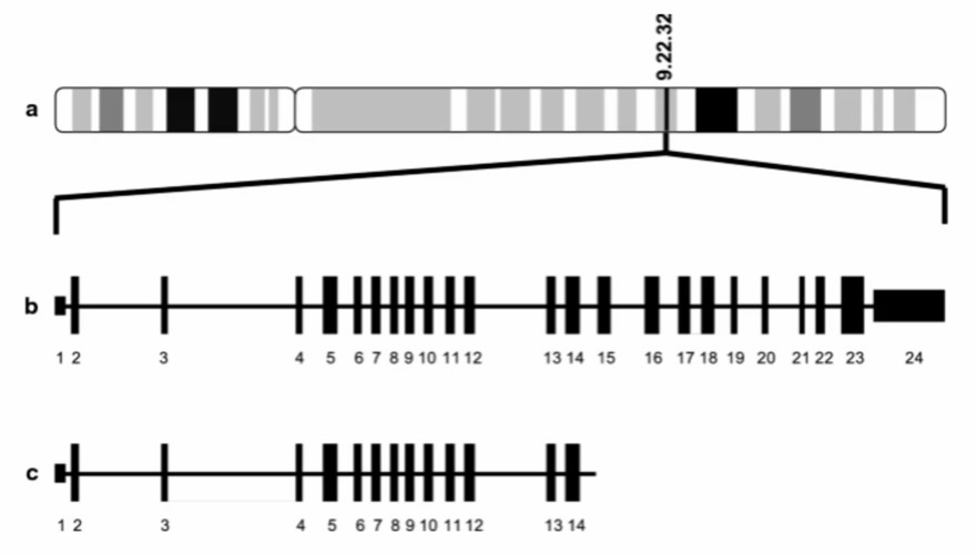 PTCH1 gene schematic. a PTCH1 origin on q arm of chromosome 9, b full length transcript with 24 exons and c mutant PTCH1 with deletion of exons 15–24.