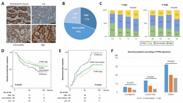 PTPRD expression and its significance in gastric cancer.