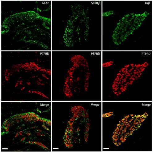 Chronic constriction injury induces PTPRD expression in dorsal root ganglion neurons.
