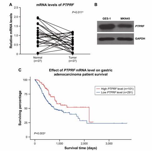PTPRF is downregulated in gastric adenocarcinoma tissue.