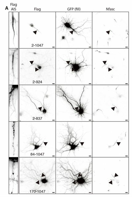 Localization of RANBP2 in mature neurons.
