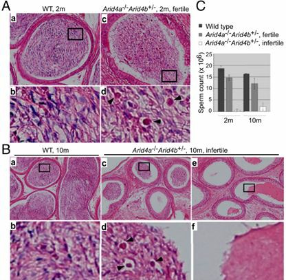 Epididymis tissue in ARID4A-deficient mice. 