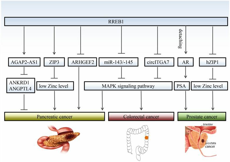 RREB1 regulates different target genes in different cancers.