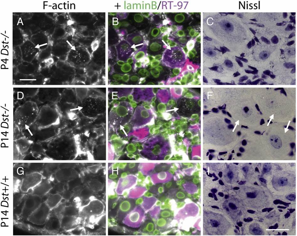 Neuronal defects in dt mice include early abnormal F-actin punctae and a widespread loss of Nissl staining.