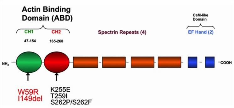 Functional domains of the human ACTN4 protein.
