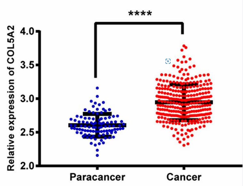 COL5A2 is up-regulated in gastric cancer tissues.