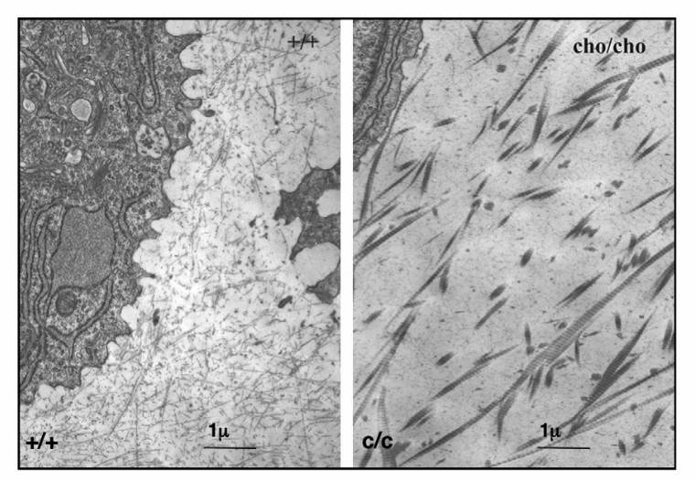 Electron Micrographs of collagen fibrils in rib cartilage extracellular matrix.