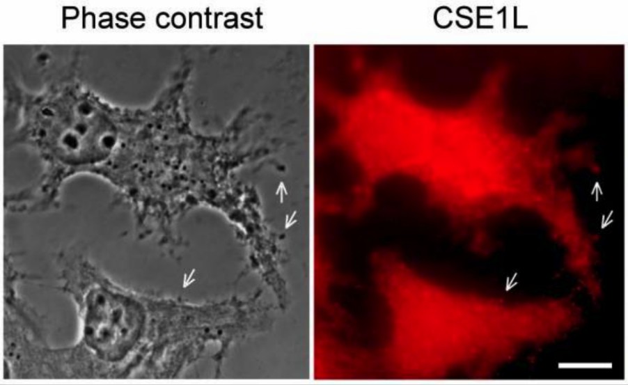 CSE1L staining in vesicles surrounding the outside of the cell membrane. 