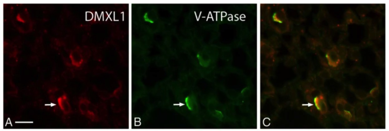 Localization of DMXL1 in proton-secreting cells of mouse kidney by immunocytochemistry.