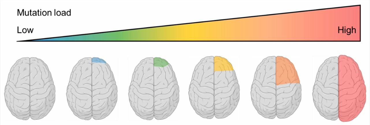 Focal cortical dysplasia (FCD) and hemimegalencephaly (HME) as a continuum of cortical dysplasias caused by commonly shared genetic variants with different mutation load.