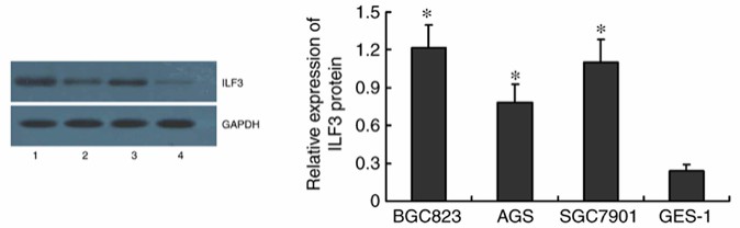 Upregulated expression of ILF3 is found in human GC cell lines compared with the gastric epithelial cell line GES‑1