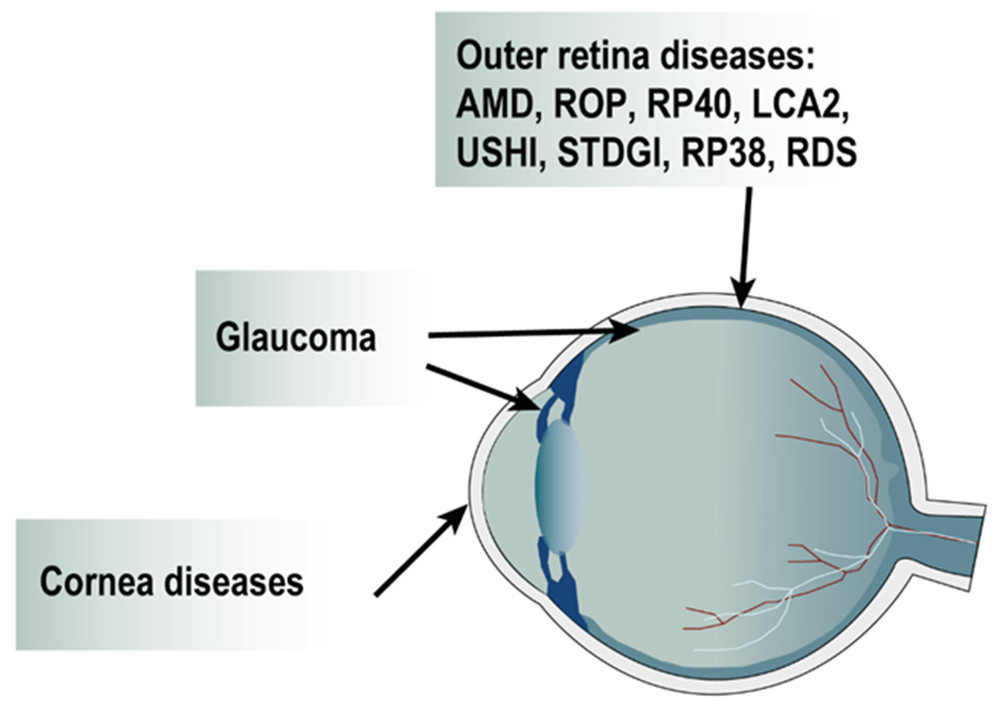Figure 1: Lentiviral Vectors and Their Targeted Human Disease Landscape.