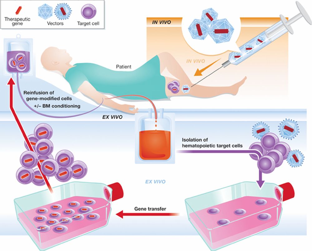 Figure 1. Comparison of direct (in vivo) and indirect (ex vivo) gene delivery approaches.