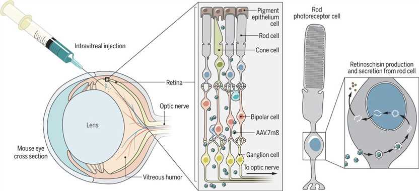 Gene replacement therapy for retinal degeneration. 