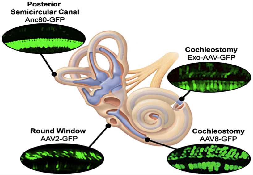 Several routes of delivery for injecting gene therapy vectors into the inner ear