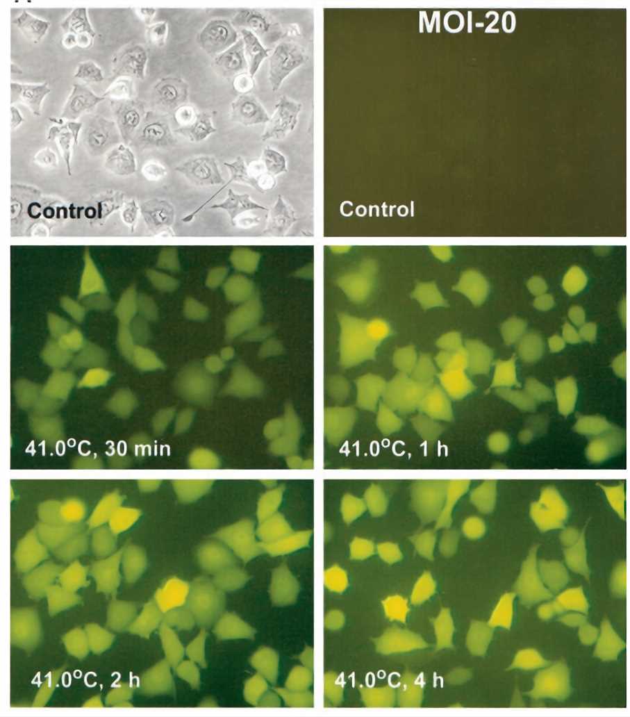 Fluorescent micrographs show heat-induced EGFP expression in Dut-145 cells infected at MOI 20 with adenovirus vectors, which contains the EGFP gene under control of the heat shock promoter.