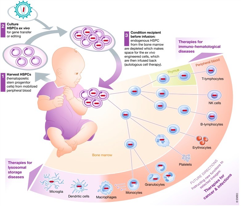  A schematic representation of HSCs-based gene therapy. 