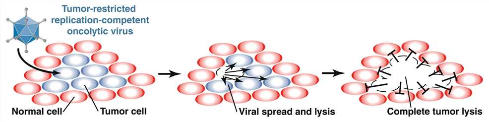 A replication-competent virus is engineered to specifically infect tumor cells, sparing healthy cells.