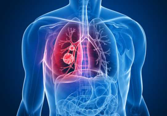 Lung Cancer-targeting Gene Therapy