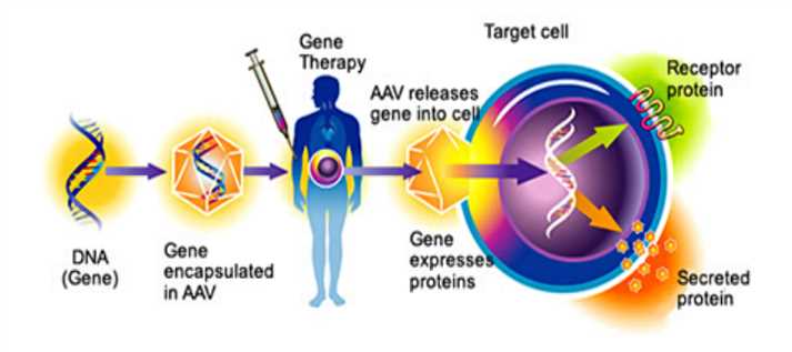 AAV vector-based gene therapy for Parkinson's disease.