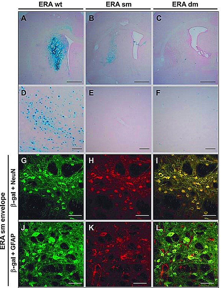 Expression of lentiviral vectors pseudotyped with ERA strains of rabies envelopes in the rat striatum. 