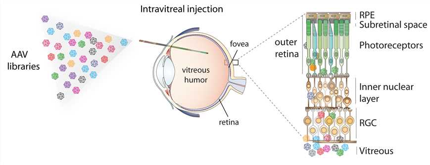 AAV-based gene therapy for ocular disease.
