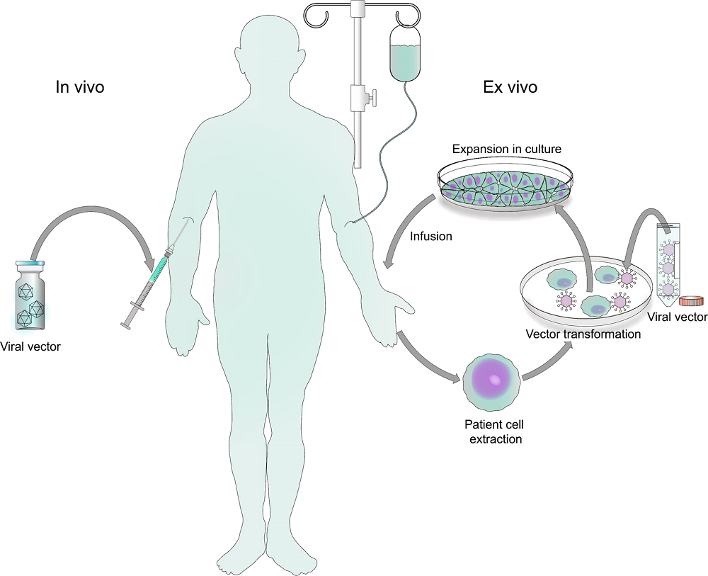 Summary of viral gene therapy modalities