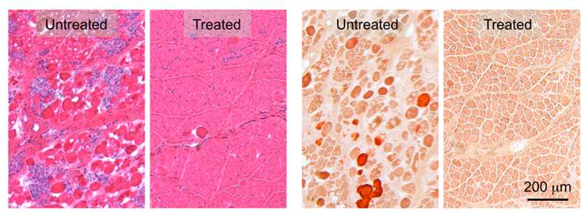 AAV micro-dystrophin therapy improved histology (left) and reduced pathological muscle calcification (right) in the ulnar extensor muscle of affected dogs.