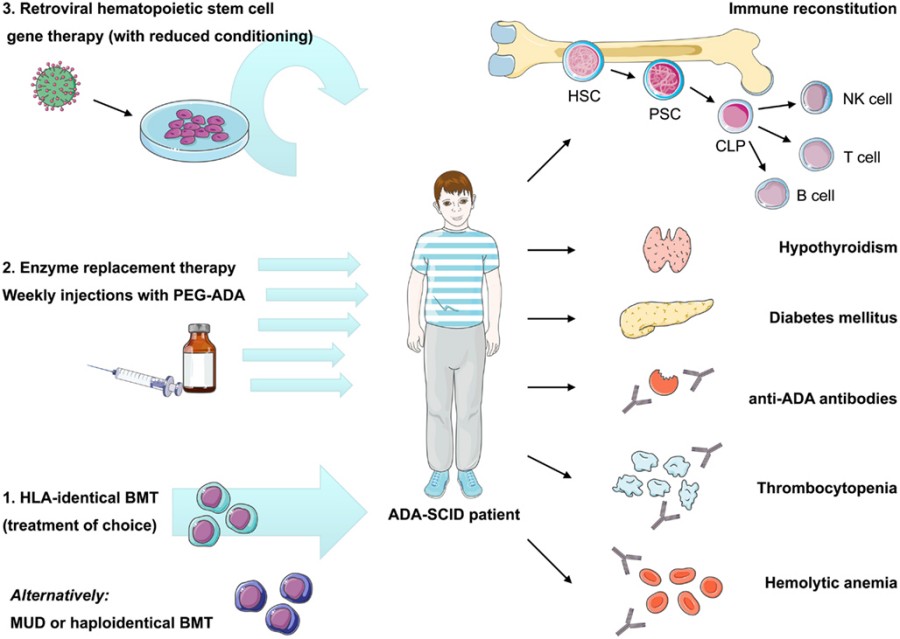 Figure 1: Current Therapeutic Approaches for ADA-SCID and Documented Autoimmune Manifestations Following Treatment. (OA Literature)