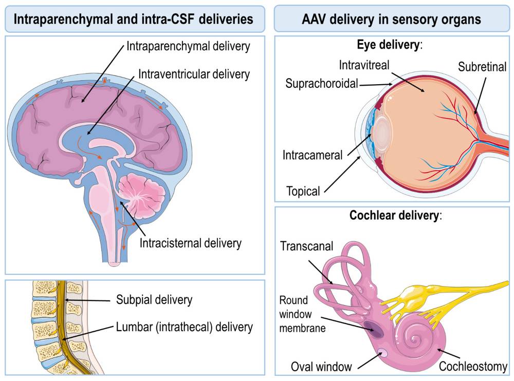 Figure 1. Depiction of the Most Commonly Used AAV Delivery Routes. (OA Literature) 