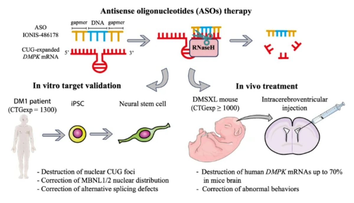 Figure 1. ASOs based gene therapy. (OA Literature)