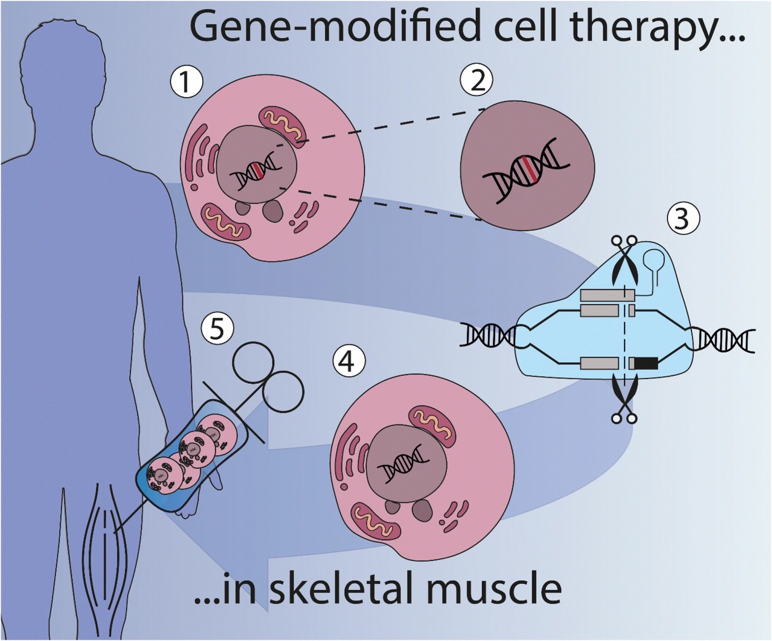 Fig.3 CAR-T manufacturing process