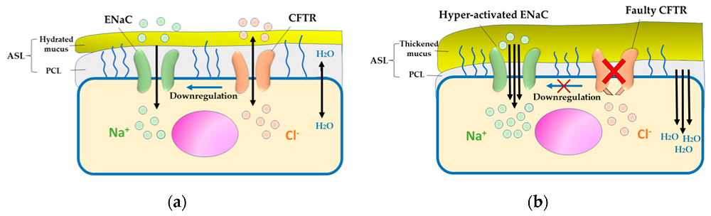 Pathogenesis of cystic fibrosis (CF)