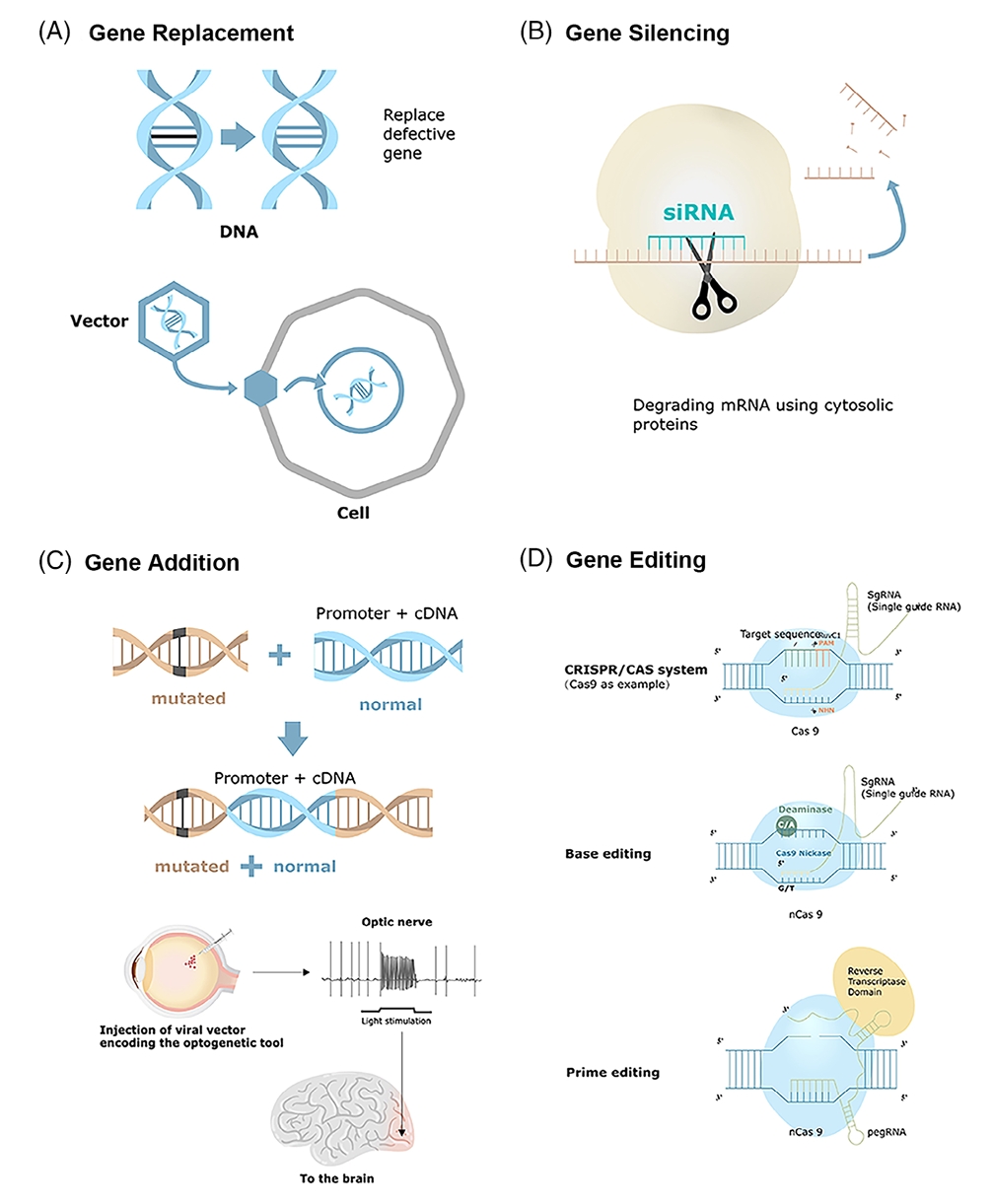 Different gene therapy strategies