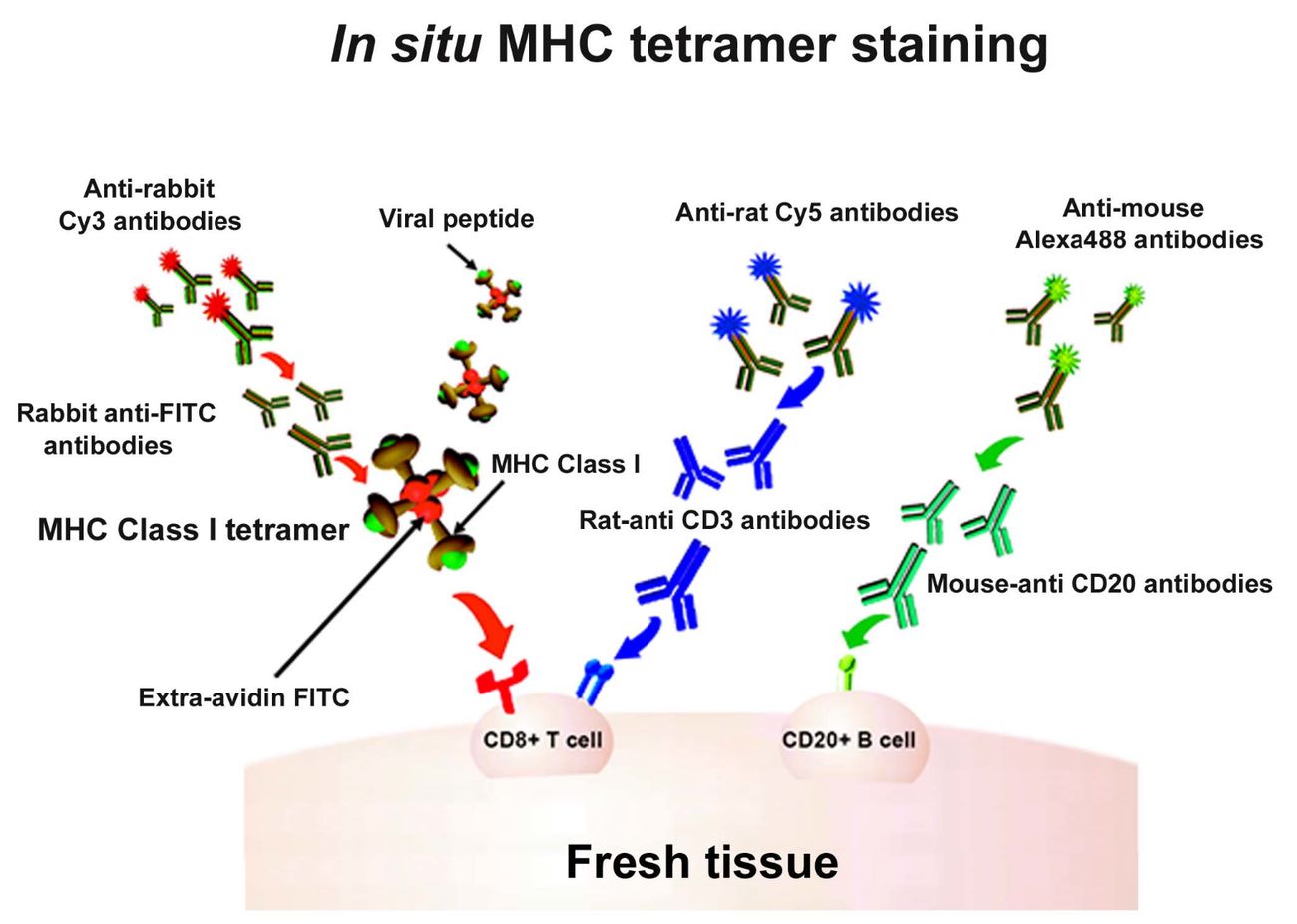 Fiure 1. In situ staining of major histocompatibility complex (MHC) class I (MHCI) tetramers combined with immunohistochemistry (IHC) for the detection of virus-specific CD8+ T cells. (OA Literature)