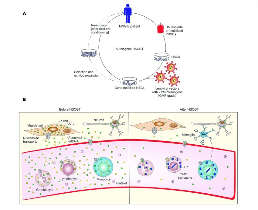 Figure 1. Illustration of autologous hematopoietic stem cell-based gene therapy for MNGIE, along with the potential mechanism of biochemical correction facilitated by gene-modified HSCs. (OA Literature)