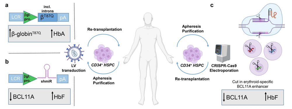 Figure 1: Autologous settings for application of targeted therapies to treat β-thalassemia or sickle cell disease due to β-globin gene mutations.. (OA Literature)
