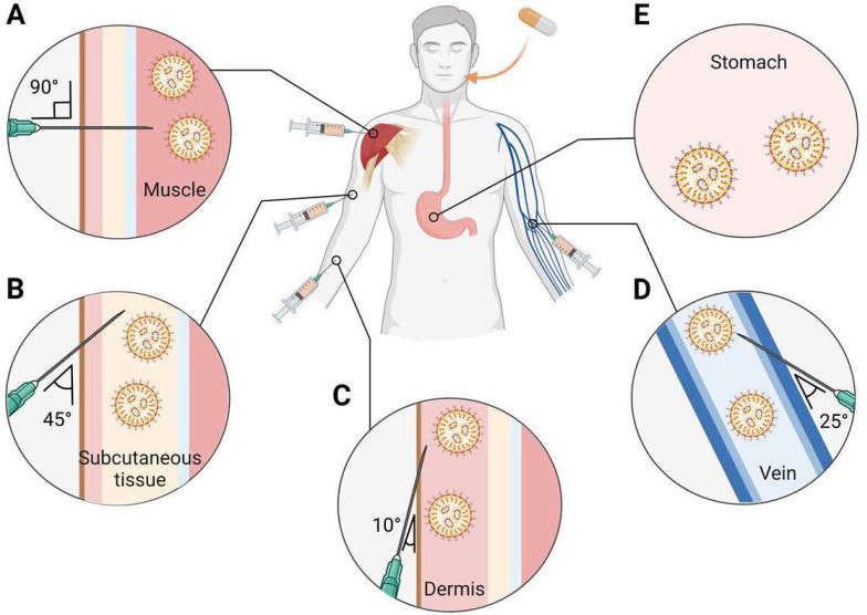 Figure 2. Systemic routes for LNP-based RNA delivery. (OA Literature)